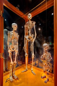 Three Mutter Museum skeletons, which may or may not have skeleton power. 